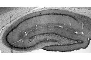Adult rat hippocampus immunohistochemistry.