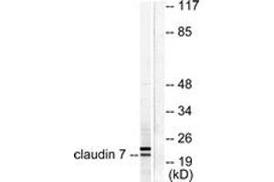 Western blot analysis of extracts from 293 cells, using Claudin 7 Antibody.