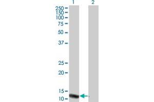 Western Blot analysis of VPREB3 expression in transfected 293T cell line by VPREB3 monoclonal antibody (M08), clone 4H8.