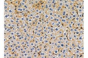 ABIN7095352 and ABIN7099409 at 1/100 staining mouse liver tissue by IHC-P. (SCARA5 Antikörper)