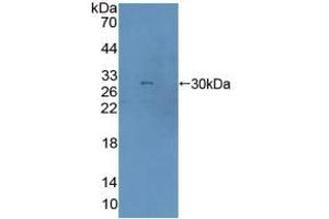 Detection of Recombinant AGA, Human using Polyclonal Antibody to Aspartylglucosaminidase (AGA) (AGA Antikörper  (AA 28-245))