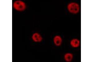 ABIN6268976 staining Hela by IF/ICC. (Cyclin D2 Antikörper  (pThr280))