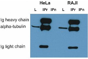 Immunoprecipitation of alpha-tubulin from HeLa and RAJI cell lysate by antibody TU-16 and its detection by antibody. (alpha Tubulin Antikörper)