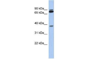 WB Suggested Anti-MGC70924 Antibody Titration: 0. (PRR19 Antikörper  (Middle Region))