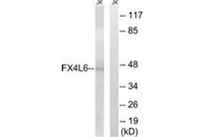 Western blot analysis of extracts from Jurkat cells, using FOXD4/L2/L3/L4/L5/L6 Antibody. (FOXD4/L2/L3/L4/L5/L6 Antikörper  (AA 281-330))