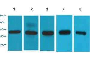 Western Blot analysis of lane 1: 293T cell, Lane 2: HeLa cell, Lane 3: HepG2 cell, Lane 4: mouse brain and Lane 5: rat brain. (EIF4A1 Antikörper  (C-Term))