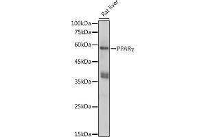 Western blot analysis of extracts of Rat liver, using PPARγ antibody (ABIN6134090, ABIN6146004, ABIN6146006 and ABIN6215096) at 1:1000 dilution.