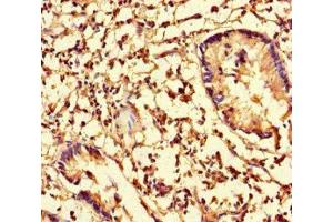 Immunohistochemistry of paraffin-embedded human appendix tissue using ABIN7148044 at dilution of 1:100 (Cofilin Antikörper  (AA 4-144))