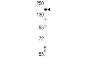 Western Blotting (WB) image for anti-Nestin (NES) (AA 1389-1416) antibody (ABIN3031961)