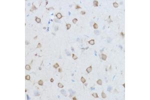 Immunohistochemistry of paraffin-embedded Mouse brain using CCT8 antibody (ABIN1679065, ABIN3018943, ABIN3018944 and ABIN6220637) at dilution of 1:100 (40x lens). (CCT8 Antikörper  (AA 248-497))
