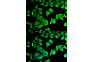 Immunofluorescence (IF) image for anti-Ribosomal Protein S12 (RPS12) antibody (ABIN1980257) (RPS12 Antikörper)