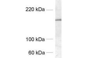 Western Blotting (WB) image for anti-GluN 2B (AA 42-60) antibody (ABIN1742497) (GluN 2B (AA 42-60) Antikörper)