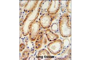 GALNT5 Antibody IHC analysis in formalin fixed and paraffin embedded human normal lung tissue followed by peroxidase conjugation of the secondary antibody and DAB staining. (GALNT5 Antikörper  (N-Term))