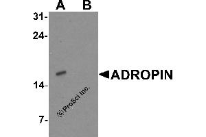 Western Blotting (WB) image for anti-Energy Homeostasis Associated (ENHO) (C-Term) antibody (ABIN2457882) (ENHO Antikörper  (C-Term))