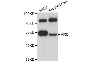 Western blot analysis of extracts of various cell lines, using ARC antibody (ABIN5995970) at 1:3000 dilution. (ARC Antikörper)