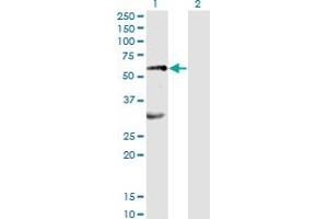 Western Blot analysis of EPOR expression in transfected 293T cell line by EPOR monoclonal antibody (M01), clone 3D10. (EPOR Antikörper  (AA 31-130))