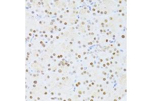 Immunohistochemistry of paraffin-embedded rat pancreas using ETV1 antibody (ABIN6129794, ABIN6140327, ABIN6140329 and ABIN6217250) at dilution of 1:100 (40x lens). (ETV1 Antikörper  (AA 80-300))