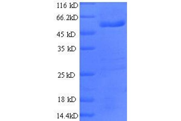 RRAGA Protein (AA 1-247, partial) (GST tag)