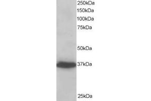 Western Blotting (WB) image for anti-PDZ and LIM Domain 4 (PDLIM4) antibody (ABIN5923210) (PDLIM4 Antikörper)