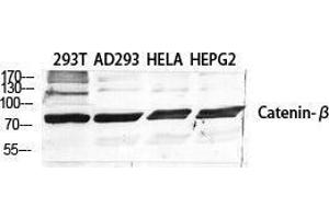 Western Blot (WB) analysis of specific cells using Catenin-beta Polyclonal Antibody. (beta Catenin Antikörper  (Ser289))