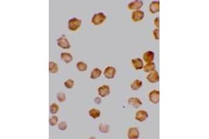 Immunocytochemistry staining of HeLa cells using AP30280PU-N DcR2 antibody at 10μg/ml. (DcR2 Antikörper  (Intracellular))