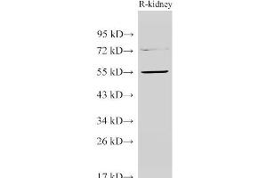 Western Blot analysis of Rat kidney using TGFBR1 Polyclonal Antibody at dilution of 1:1000 (TGFBR1 Antikörper)