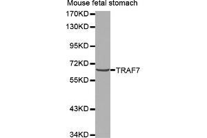 Western blot analysis of extracts of mouse fetal stomach, using TRAF7 antibody (ABIN5971582).