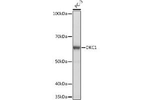 Western blot analysis of extracts of PC-3 cells, using DKC1 Rabbit mAb (ABIN7266869) at 1:1000 dilution. (DKC1 Antikörper)