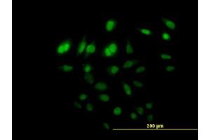 Immunofluorescence of purified MaxPab antibody to C8orf72 on HeLa cell.