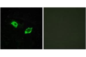 Immunofluorescence analysis of HuvEc cells, using GPR158 Antibody. (GPR158 Antikörper  (AA 1-50))