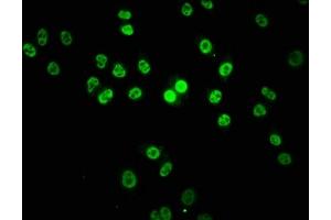 Immunofluorescence staining of Hela cells with ABIN7155462 at 1:133, counter-stained with DAPI. (Lysine (K)-Specific Methyltransferase 2B (KMT2B) (AA 145-290) Antikörper)