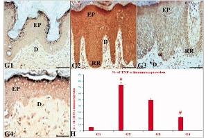 The effects of ustekinumab and the CUC on the immunoexpression (IE) of TNF-α in IQ-induced psoriatic skin lesions. (TNF alpha Antikörper)