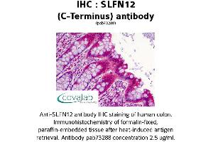Image no. 2 for anti-Schlafen Family Member 12 (SLFN12) (C-Term) antibody (ABIN1739425) (SLFN12 Antikörper  (C-Term))