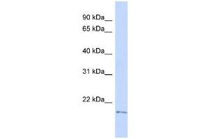 WB Suggested Anti-TGIF2LY Antibody Titration:  0. (TGIF2LY Antikörper  (Middle Region))