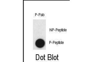 Dot blot analysis of anti-Phospho-CLDN2-p Antibody (ABIN390022 and ABIN2839781) on nitrocellulose membrane. (Claudin 2 Antikörper  (pTyr224))
