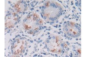 DAB staining on IHC-P; Samples: Human Stomach Tissue (LPHN3 Antikörper  (AA 1105-1447))