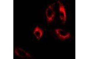Immunofluorescent analysis of GAD2 staining in A549 cells. (GAD65 Antikörper)