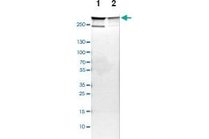 Western blot analysis of Lane 1: NIH-3T3 cell lysate (Mouse embryonic fibroblast cells), Lane 2: NBT-II cell lysate (Rat Wistar bladder tumour cells) with FLNA polyclonal antibody  at 1:100-1:500 dilution. (Filamin A Antikörper)