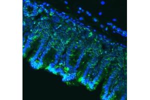 IF analysis of Claudin18/CLDN18 using anti-Claudin18/CLDN18 antibody (ABIN7601257). (Claudin 18 Antikörper  (AA 31-261))