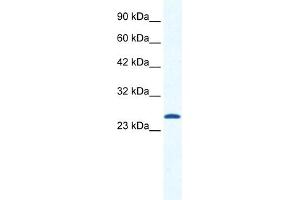 Western Blotting (WB) image for anti-Calcium Channel, Voltage-Dependent, gamma Subunit 6 (CACNG6) (N-Term) antibody (ABIN2776283)