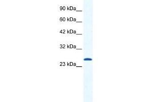 WB Suggested Anti-CACNG6 Antibody Titration:  1. (CACNG6 Antikörper  (N-Term))
