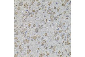 Immunohistochemistry of paraffin-embedded mouse brain using COL1A2 antibody. (COL1A2 Antikörper)