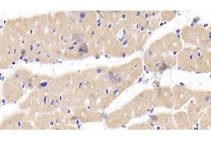 Immunohistochemistry (IHC) image for anti-Tumor Necrosis Factor Receptor Superfamily, Member 11b (TNFRSF11B) (AA 1-196) antibody (ABIN7431044)