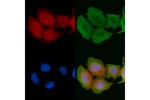 ABIN6256923 and ABIN6274414 staining Hela cells(45 min of heat-shock) by IF/ICC. (ADCK1 Antikörper  (Internal Region))