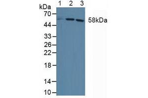 Western blot analysis of (1) Human HepG2 Cells, (2) Human Jurkat Cells and (3) Human HeLa cells. (DKC1 Antikörper  (AA 298-465))