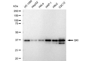 Western blotting analysis using QKI antibody (ABIN7800036).