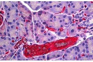 Rat Pancreas, Vessel: Formalin-Fixed, Paraffin-Embedded (FFPE) (RECA-1 Antikörper)