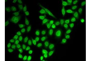 Immunofluorescence analysis of MCF-7 cells using RanG antibody (ABIN6128613, ABIN6146681, ABIN6146683 and ABIN6217306). (RANGAP1 Antikörper  (AA 398-587))