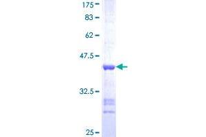 CAMK2D Protein (AA 301-410) (GST tag)