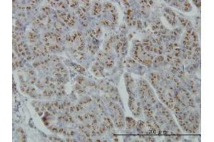 Image no. 1 for anti-Mannosyl (Alpha-1,3-)-Glycoprotein beta-1,4-N-Acetylglucosaminyltransferase, Isozyme A (MGAT4A) (AA 436-536) antibody (ABIN599178) (MGAT4A Antikörper  (AA 436-536))